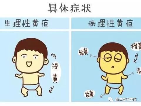 婴儿黄疸一个月不退，原因、影响与应对措施